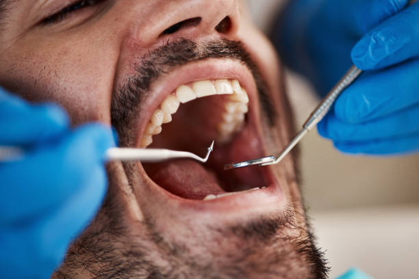 Best Emergency Dentist for Knocked-Out Tooth in Farragut, TN