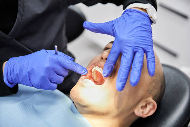 Best Emergency Dental Extractions in Farragut, TN