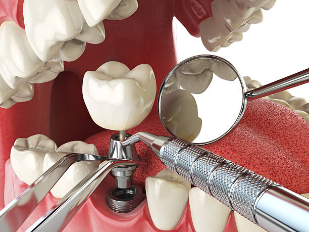 Best Emergency Dentist for Special Needs Patients in Farragut, TN